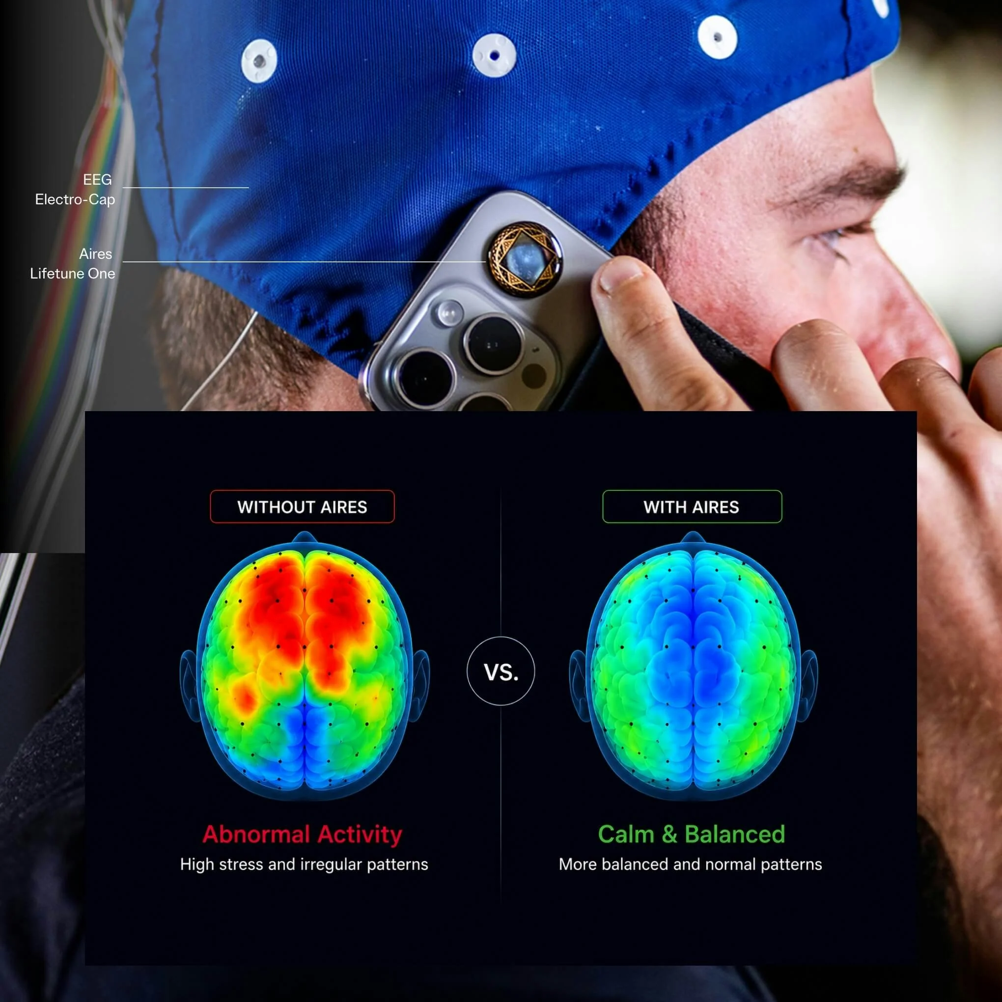 Aires Tech EEG brain scan research visualization